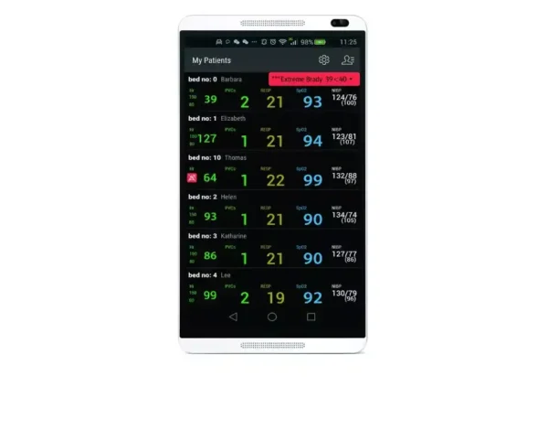 Mobile App for BeneVision Central Monitoring Station