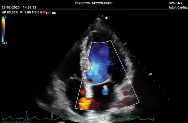 ME 8 Laptop Ultrasound Machine - Image 3