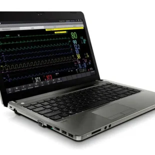 Remote Patient Monitoring for Tablet, Laptop or PC - BeneVision CMS Viewer