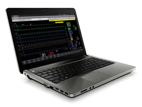 Remote Patient Monitoring for Tablet, Laptop or PC - BeneVision CMS Viewer