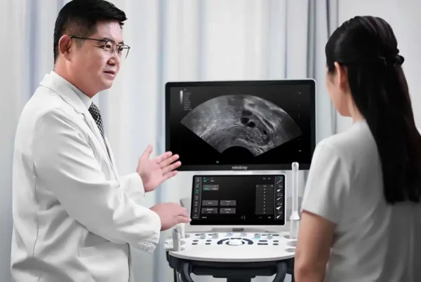 Consona N6 Diagnostic Ultrasound System - Image 4