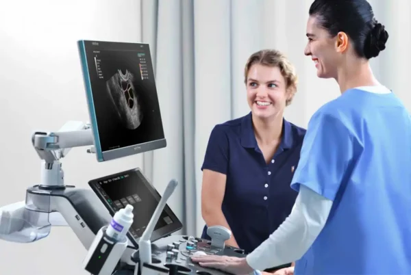 Consona N9 Ultrasound Machine - Image 2