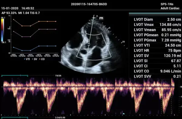 ME 8 Laptop Ultrasound Machine - Image 4