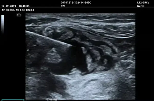 ME 8 Laptop Ultrasound Machine - Image 5