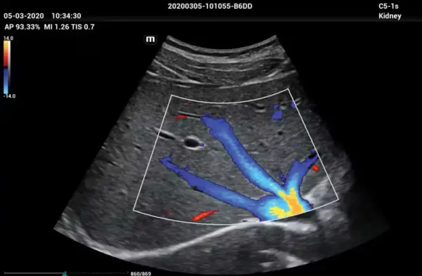 ME 8 Laptop Ultrasound Machine - Image 6