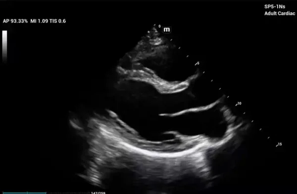 ME 8 Laptop Ultrasound Machine - Image 8