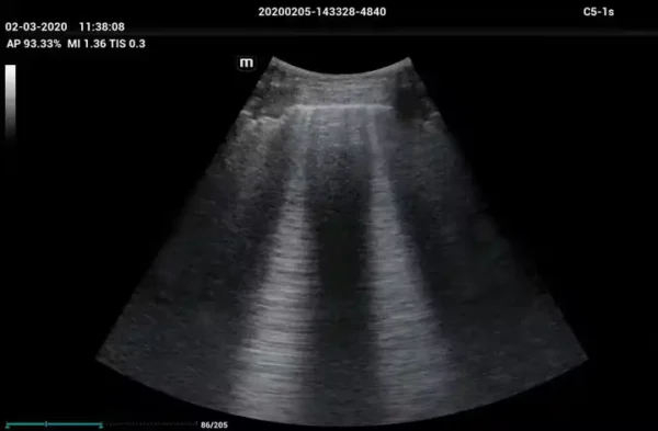 ME 8 Laptop Ultrasound Machine - Image 7