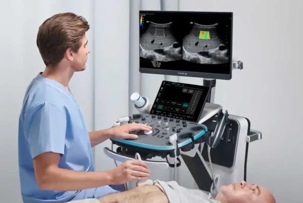 Resona I8 Ultrasound Machine - Image 4