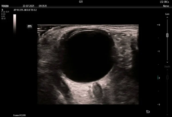 TE X Portable Ultrasound System - Image 4