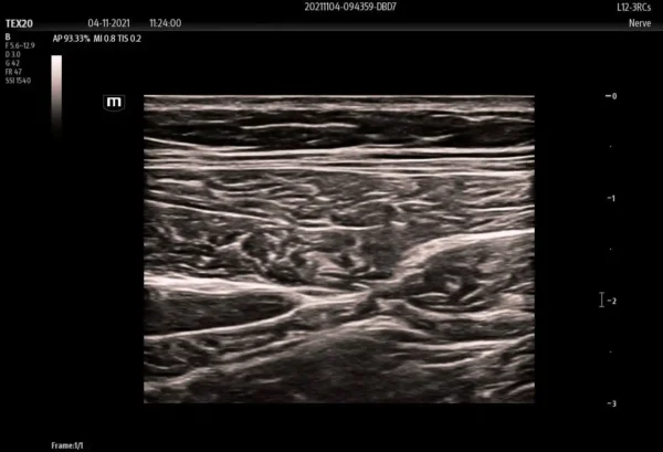 TE X Portable Ultrasound System - Image 5