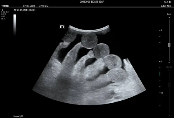 TE X Portable Ultrasound System - Image 6