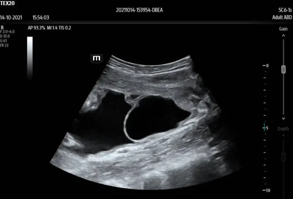 TE X Portable Ultrasound System - Image 7