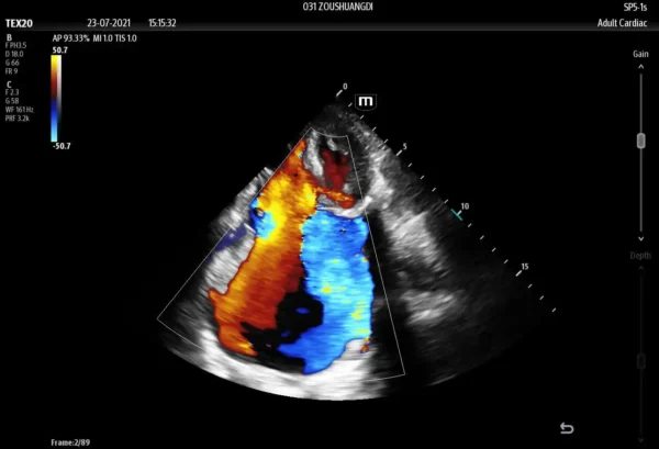 TE X Portable Ultrasound System - Image 9
