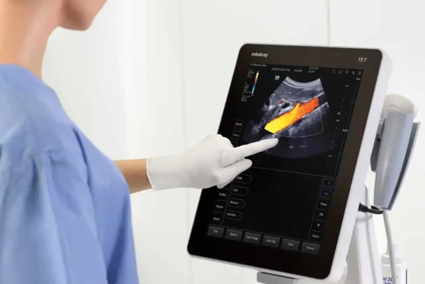 TE5 Ultrasound System - Image 2