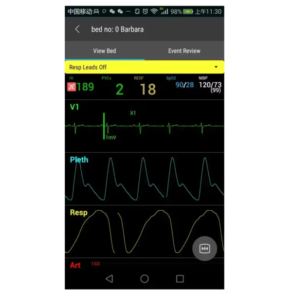 Mobile App for BeneVision Central Monitoring Station - Image 4