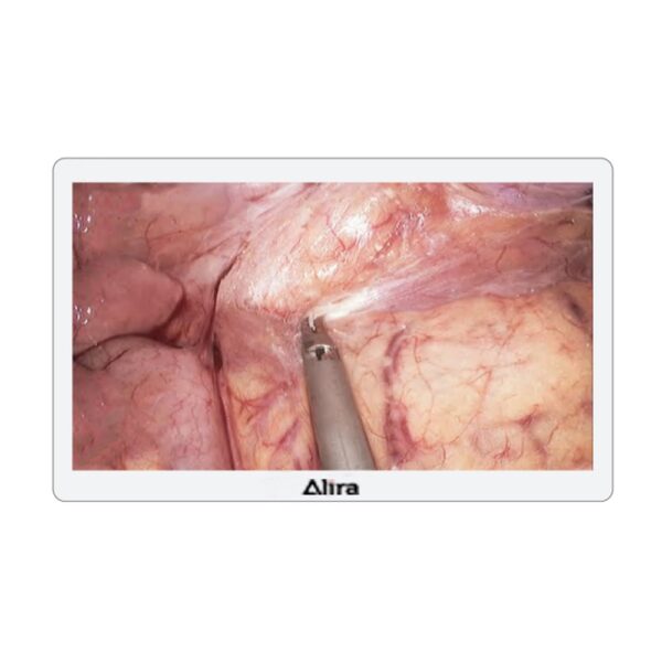 4K Endoscopic Medical Monitor