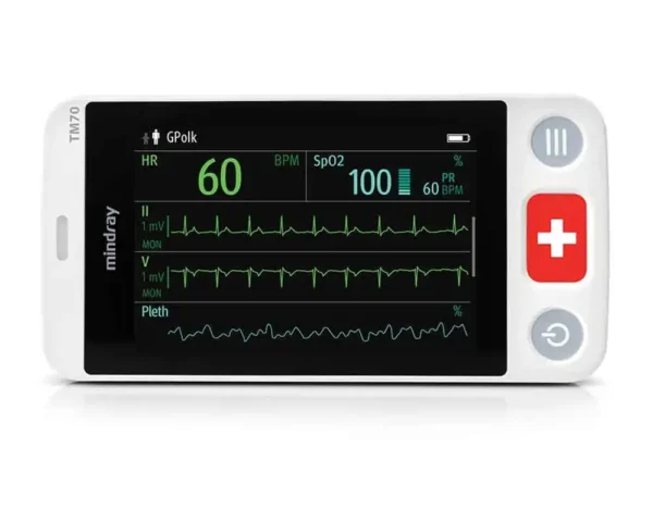 BeneVision TM70 Telemetry Transmitter - Image 2