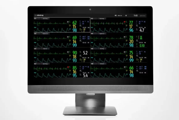BeneVision DMS Central Monitoring System - Image 3