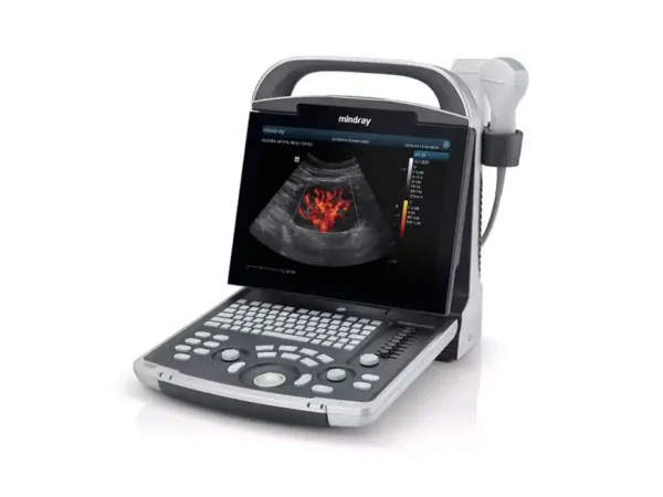 The DP-30 Power Ultrasound Imaging System