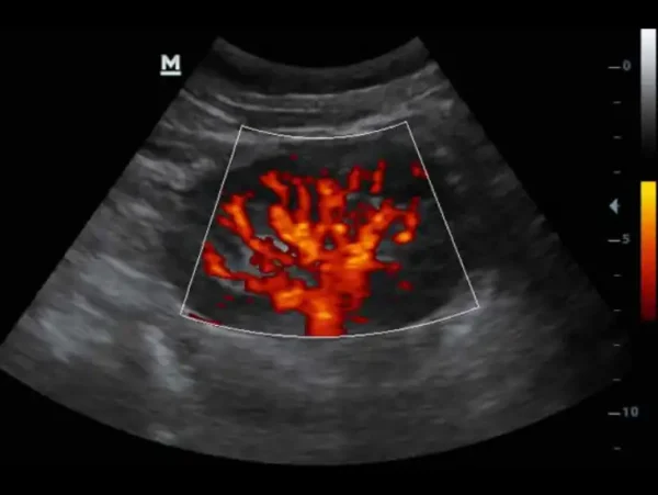 The DP-30 Power Ultrasound Imaging System - Image 2