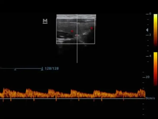 The DP-30 Power Ultrasound Imaging System - Image 3