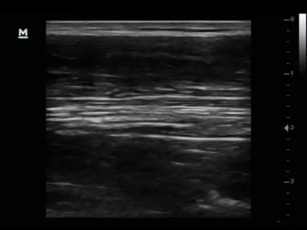 The DP-30 Power Ultrasound Imaging System - Image 4