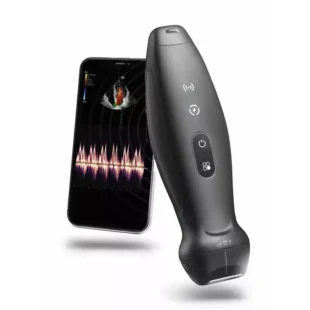 TE Air i3P Handheld Ultrasound Machine