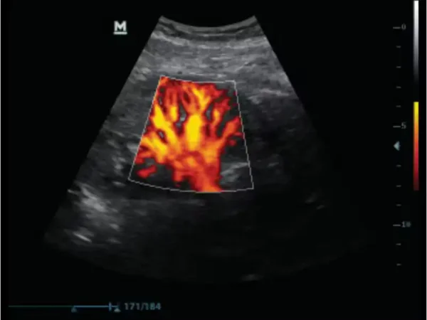 DP-50 Expert Mobile Ultrasound System - Image 4