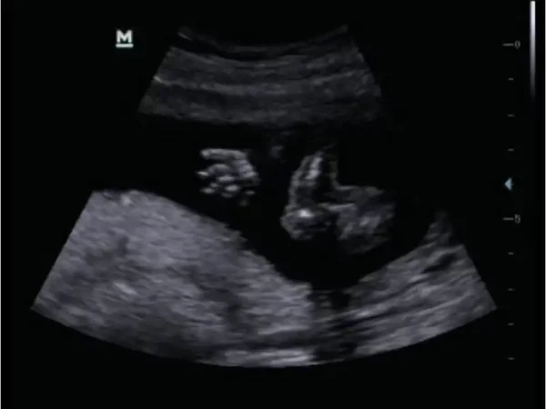 DP-50 Expert Mobile Ultrasound System - Image 5