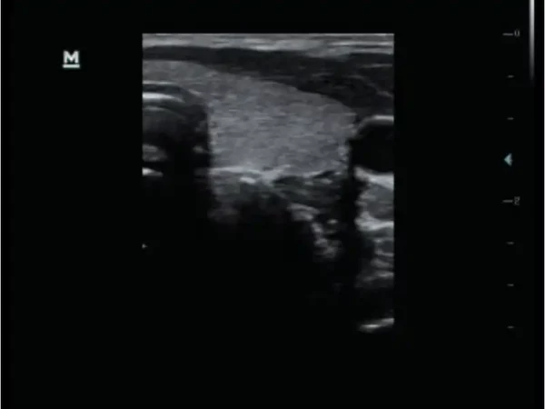 DP-50 Expert Mobile Ultrasound System - Image 6