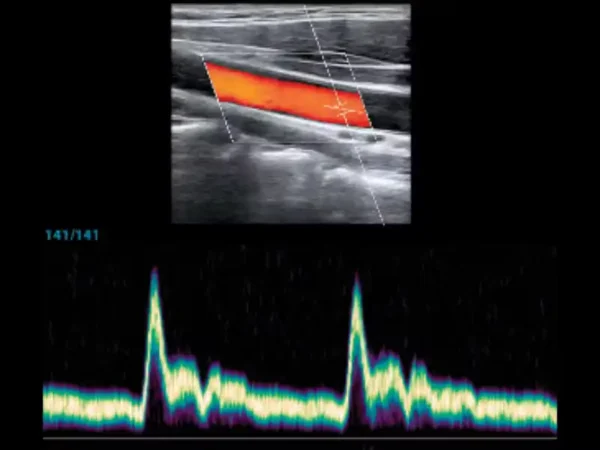 M8 Elite Diagnostic Ultrasound System - Image 2