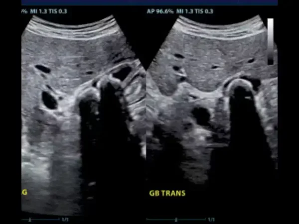 M8 Elite Diagnostic Ultrasound System - Image 3