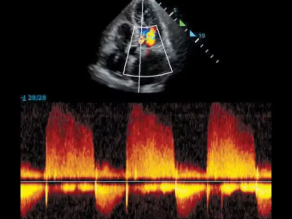 M8 Elite Diagnostic Ultrasound System - Image 4