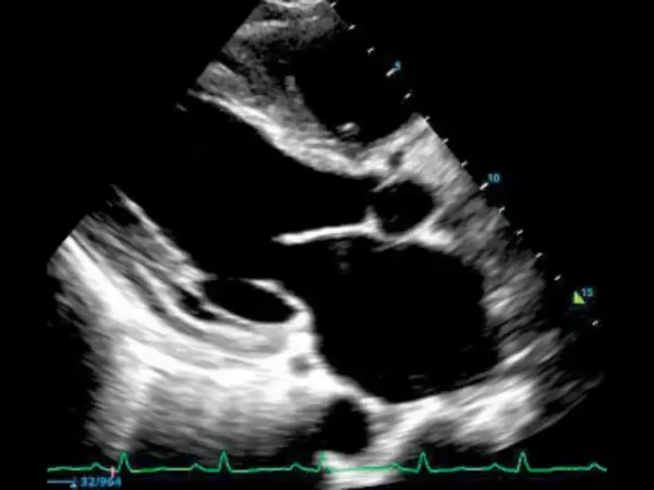 M8 Elite Diagnostic Ultrasound System - Image 5