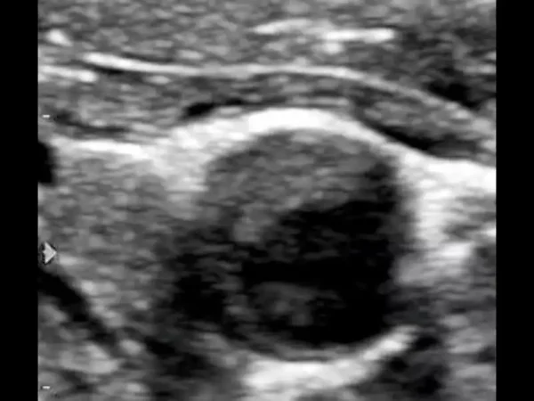 M8 Elite Diagnostic Ultrasound System - Image 6