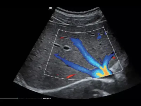 MX7 Laptop Ultrasound Machine - Image 2