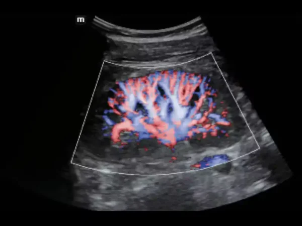 MX7 Laptop Ultrasound Machine - Image 3