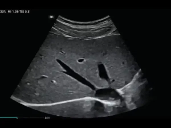 MX7 Laptop Ultrasound Machine - Image 4