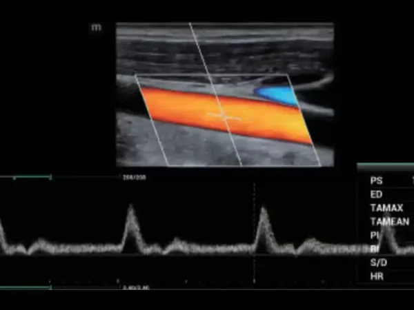 MX7 Laptop Ultrasound Machine - Image 5