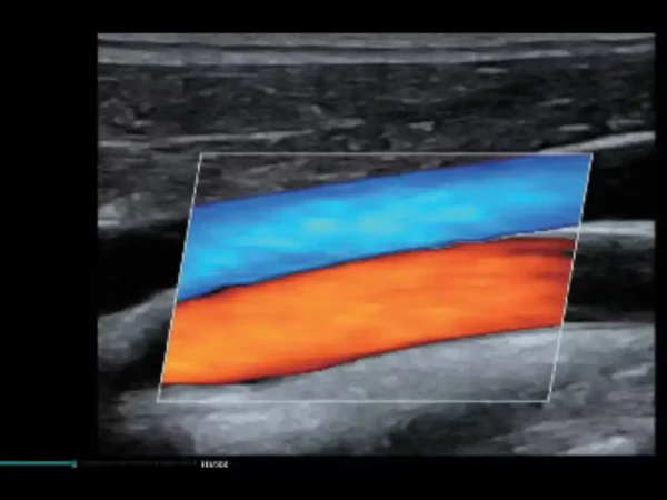 MX7 Laptop Ultrasound Machine - Image 6