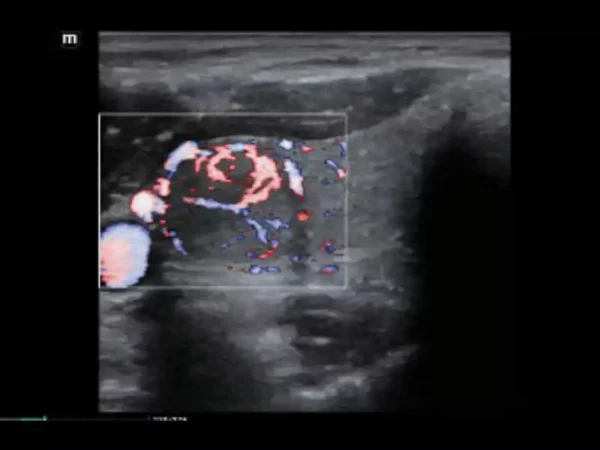 MX7 Laptop Ultrasound Machine - Image 7