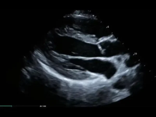MX7 Laptop Ultrasound Machine - Image 8