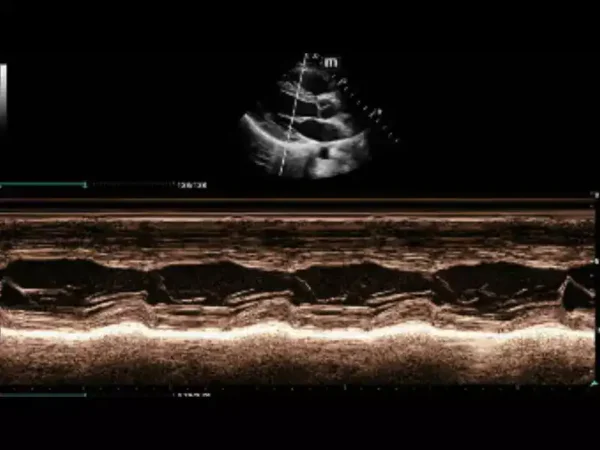 MX7 Laptop Ultrasound Machine - Image 9