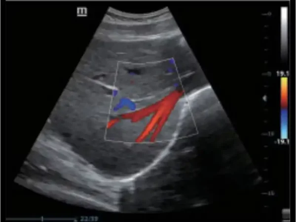 Z60 Hand-carried Ultrasound System - Image 2