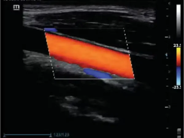 Z60 Hand-carried Ultrasound System - Image 3