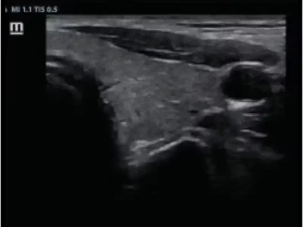 Z60 Hand-carried Ultrasound System - Image 4